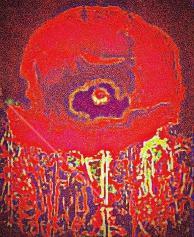 poppy flower
