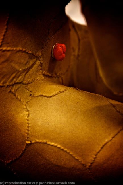 Mercy's skin and stoma