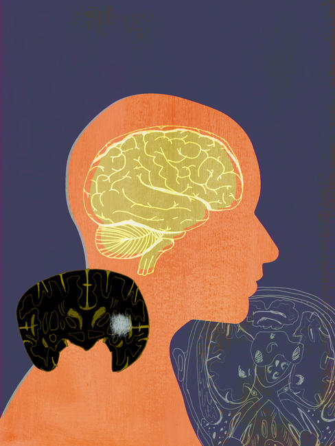 Brain (book cover artwork)