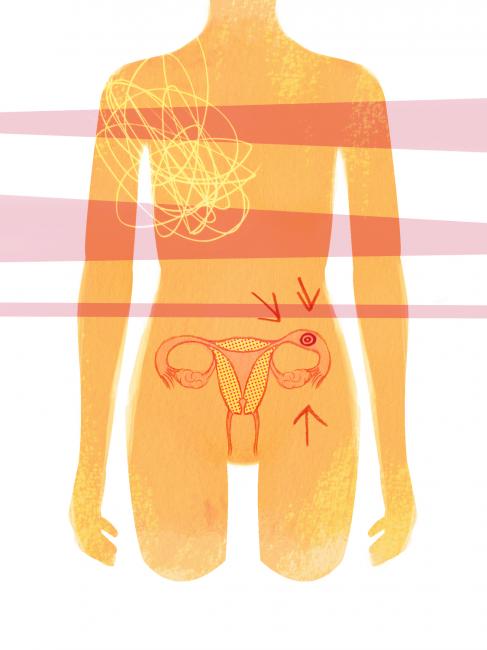 Ectopic pregnancy