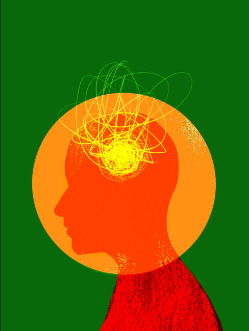 Epilepsy III