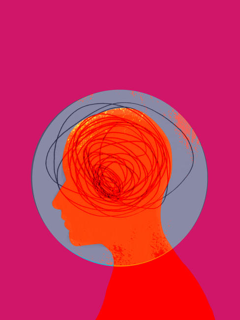 Epilepsy