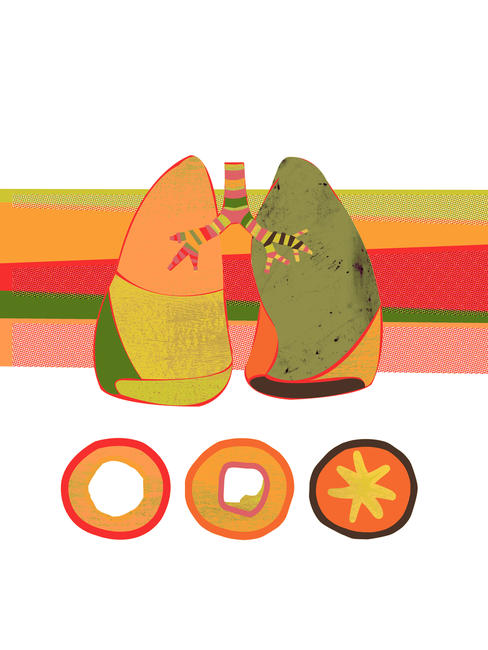 Bronchitis II (book cover artwork)