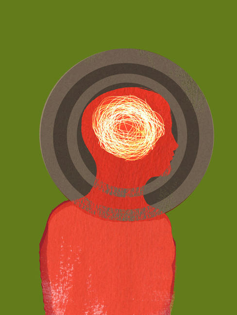 Migraine