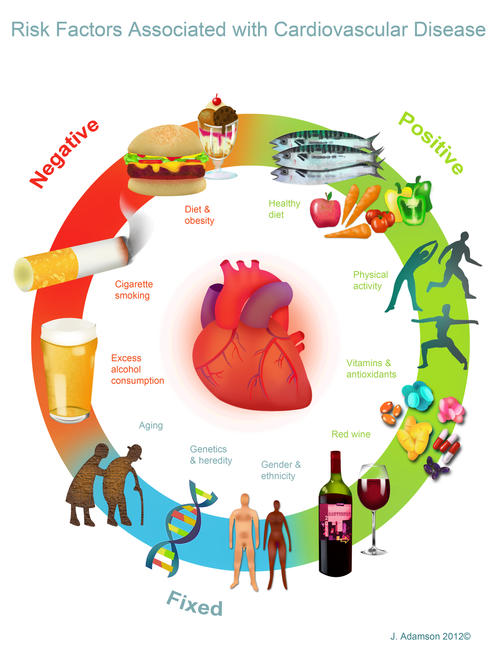 CVD (textbook illustration)