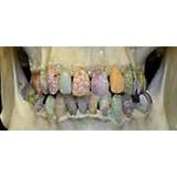 A Thing of the Past 02