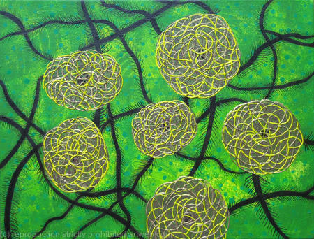 Abstracted Lata Balls