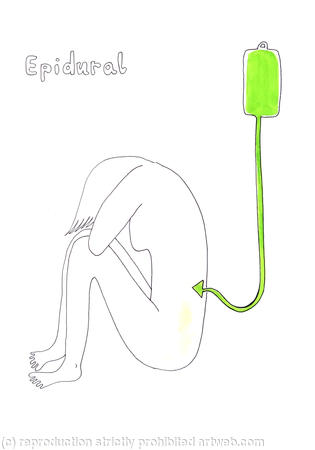 The Epidural