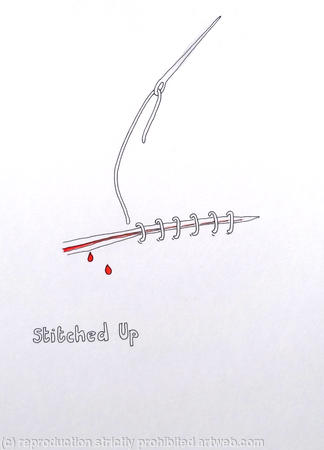 Stitched Up