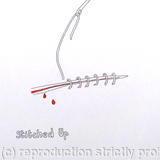 Stitched Up